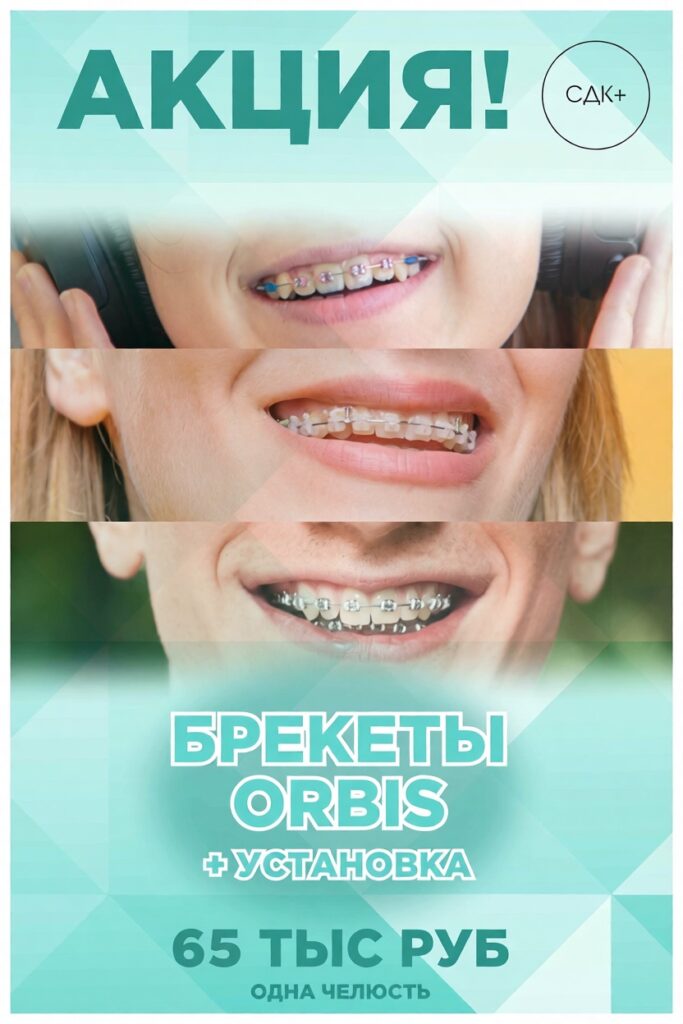 Брекеты акция